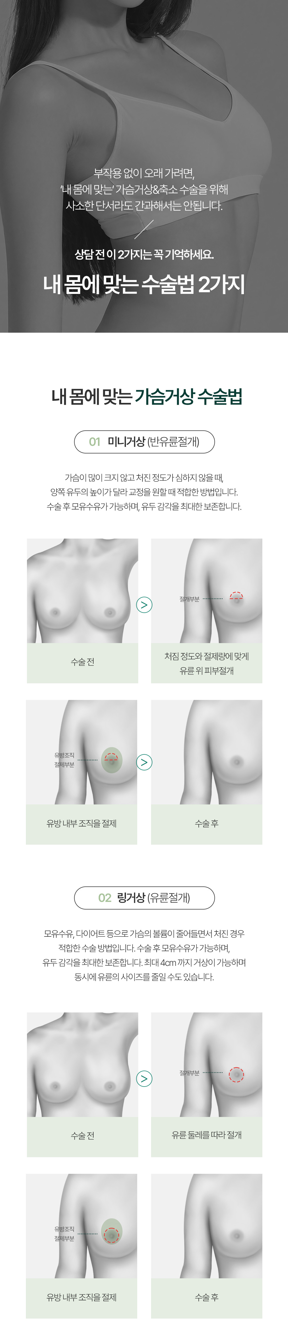 축소/거상 이미지 15