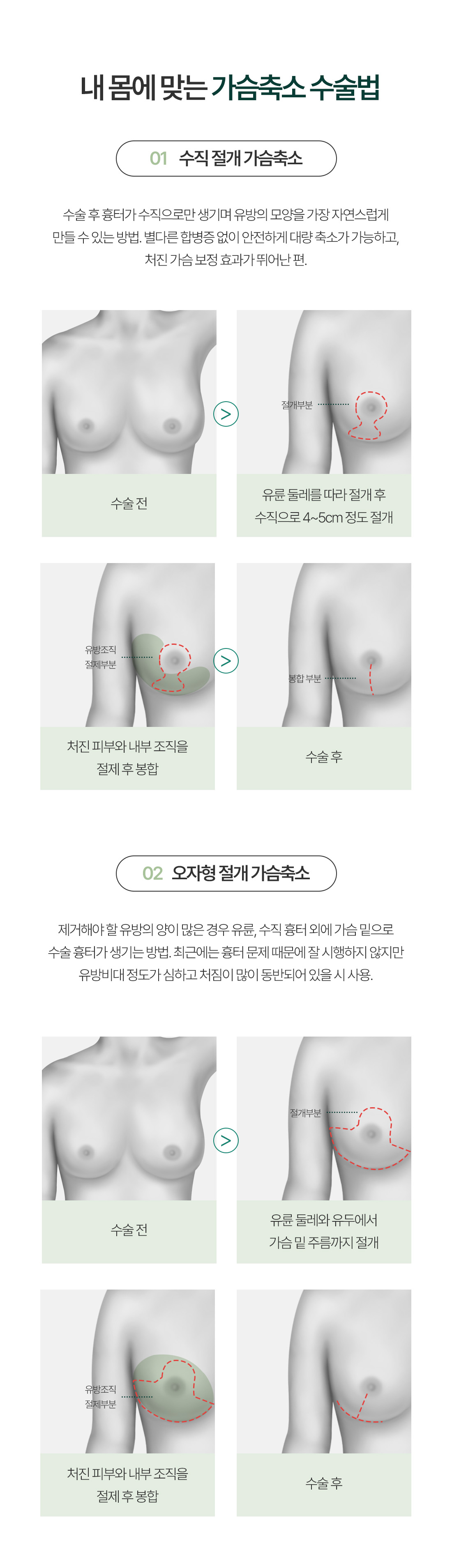 축소/거상 이미지 16