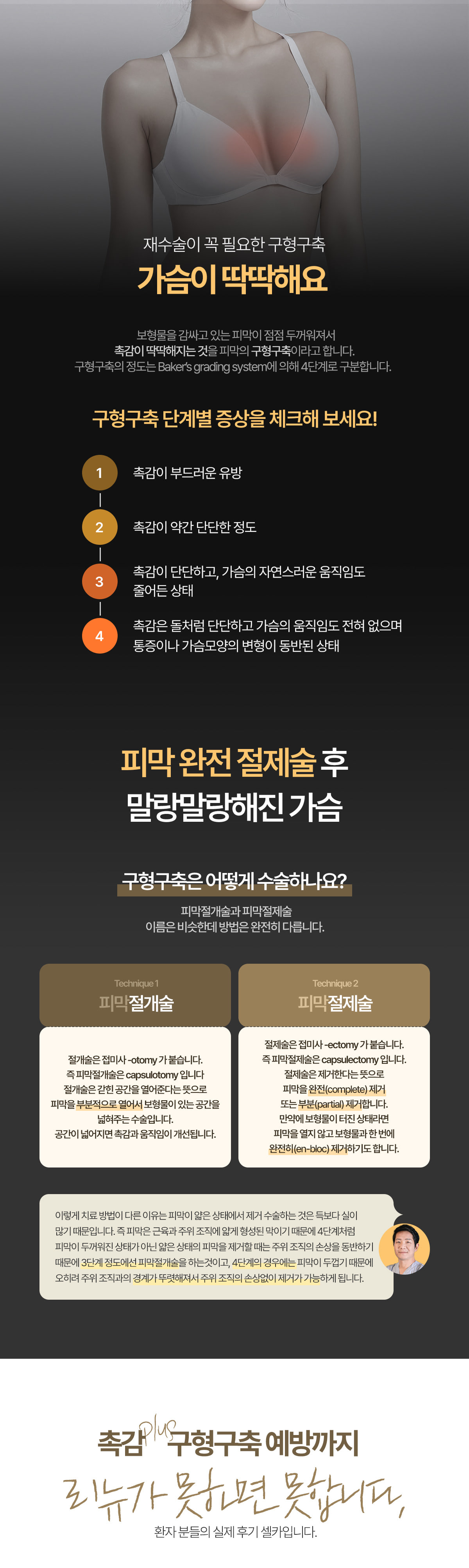 가슴 재수술 이미지 9